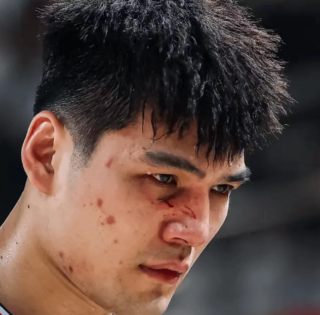 开云网页版-伤痕明显！广州状元陈国豪面部骨裂 季后赛大概率戴面具对阵广东